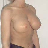 Patient # 56310 After Photo # 2