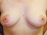 Patient # 54943 After Photo # 2