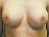 Patient # 89786 After Photo # 2
