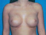 Patient # 17132 After Photo # 2