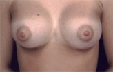 Patient # 25464 After Photo # 2