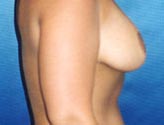 Patient # 98259 After Photo # 6