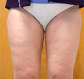 Patient # 18906 After Photo # 2