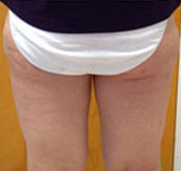 Patient # 18906 After Photo # 4