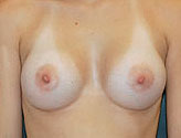 Patient # 19270 After Photo # 2