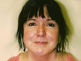 Patient # 18137 After Photo # 2
