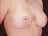 Patient # 45977 After Photo # 4